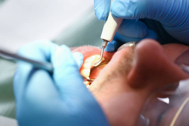 Best Emergency Tooth Extraction  in Granville, WV