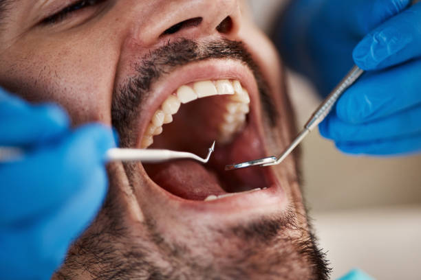 Best Broken Tooth Emergency  in Granville, WV